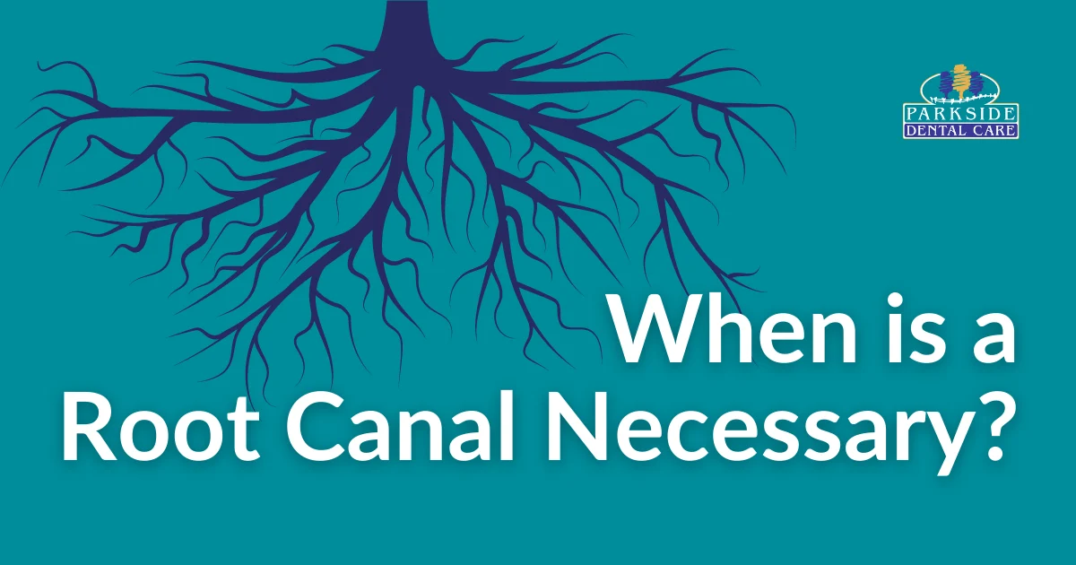 When Is a Root Canal Necessary?