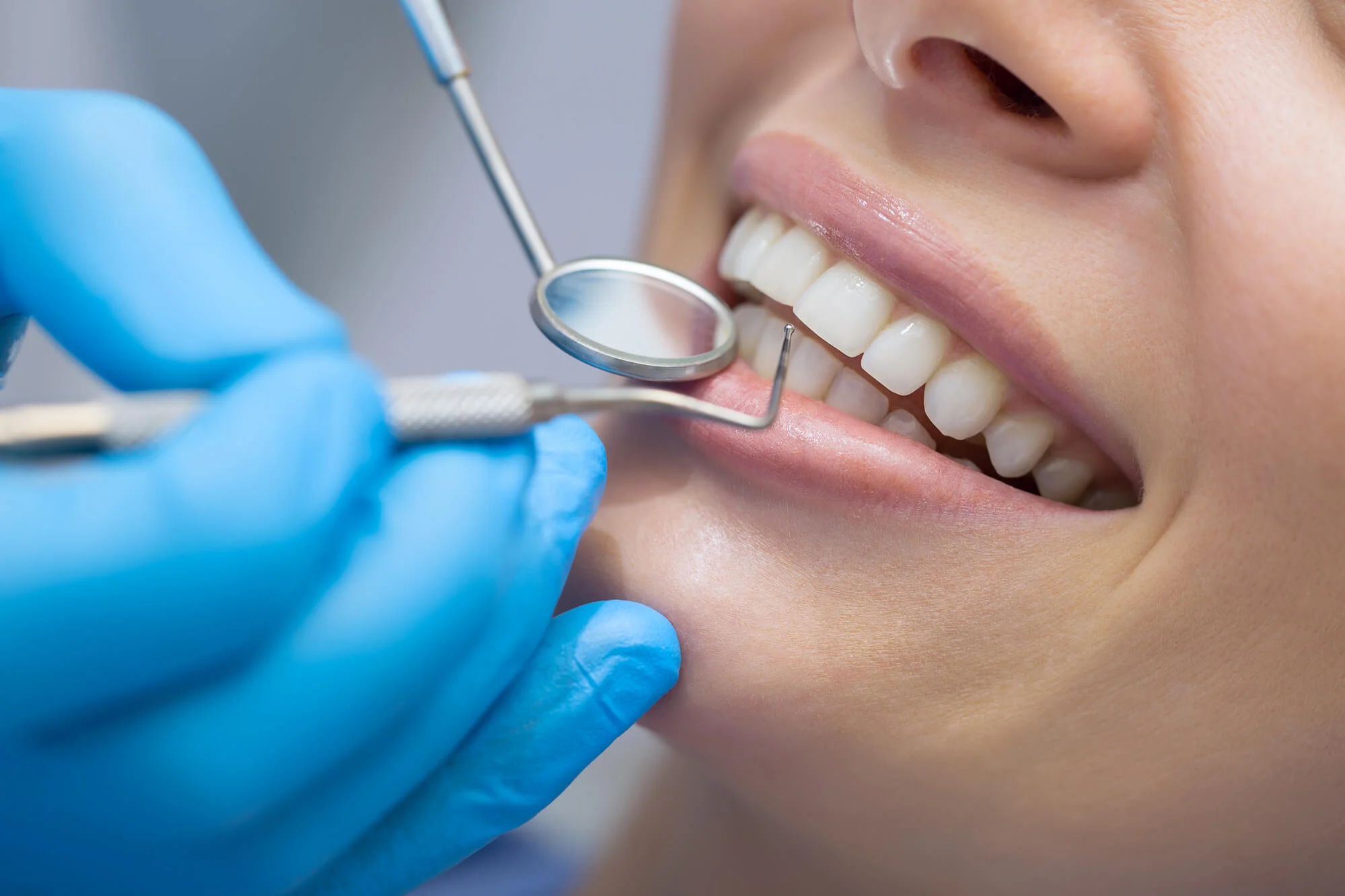 get dental implants in montgomery al