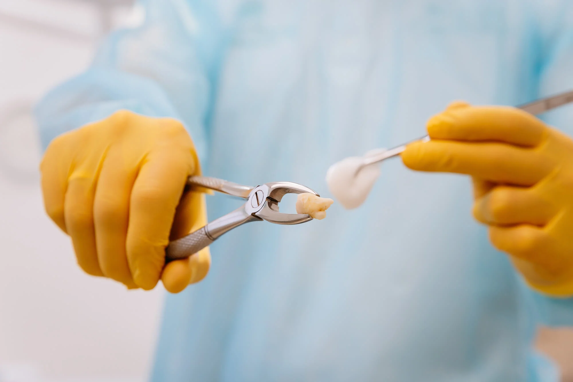 tooth extraction cost Alabama