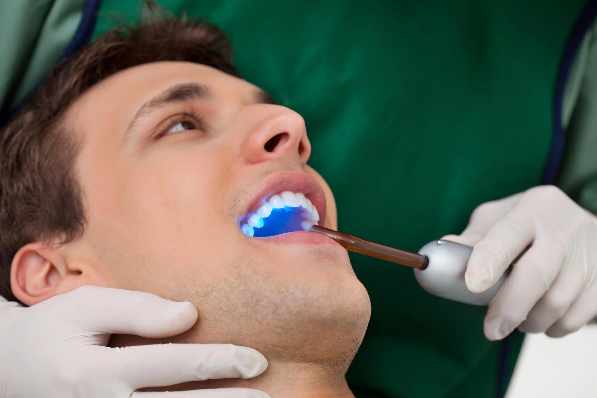Montgomery Dentist Explains When to Get Dental Bonding