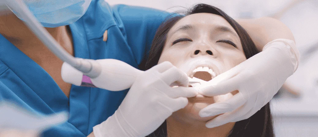 Scaling and Root Planing for Periodontal Disease